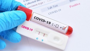 Các địa phương lập đoàn kiểm tra việc kinh doanh test Covid-19 Các địa phương lập đoàn kiểm tra việc kinh doanh test Covid-19