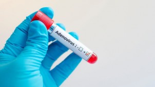 Những dấu hiệu nhận biết bệnh viêm gan bí ẩn ở trẻ em