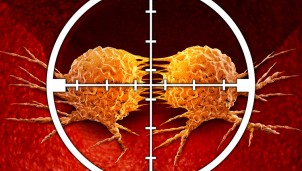 Virus diệt ung thư - Thử nghiệm mới mang lại hy vong cho người bệnh Virus diệt ung thư - Thử nghiệm mới mang lại hy vong cho người bệnh