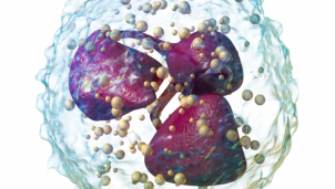 Neutriphil - Tế bài miễn dịch là tác nhân gây nguy hiểm cho bệnh nhân ung thư não Neutriphil - Tế bài miễn dịch là tác nhân gây nguy hiểm cho bệnh nhân ung thư não