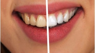 Lời khuyên của chuyên gia: Mỗi ngày dành 10 phút để chăm sóc răng miệng Lời khuyên của chuyên gia: Mỗi ngày dành 10 phút để chăm sóc răng miệng