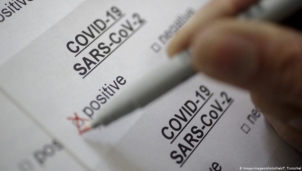 Làm giả kết quả xét nghiệm dương tính SARS-CoV-2