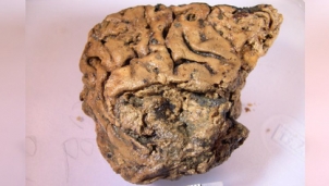 Mô não người vẫn ‘còn nguyên’ sau 2.600 năm