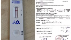 Tại sao test nhanh âm tính nhưng PCR thì dương tính? Tại sao test nhanh âm tính nhưng PCR thì dương tính?