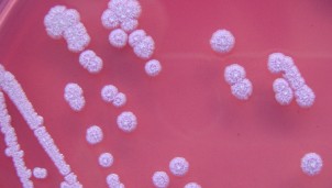 Vi khuẩn chết người Whitmore lần đầu tiên được tìm thấy ở Hoa Kỳ