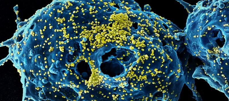 Nghiên cứu cũng đã chỉ ra rằng virus SARS-CoV-2 có thể tấn công đến mọi cơ quan trong cơ thể con người