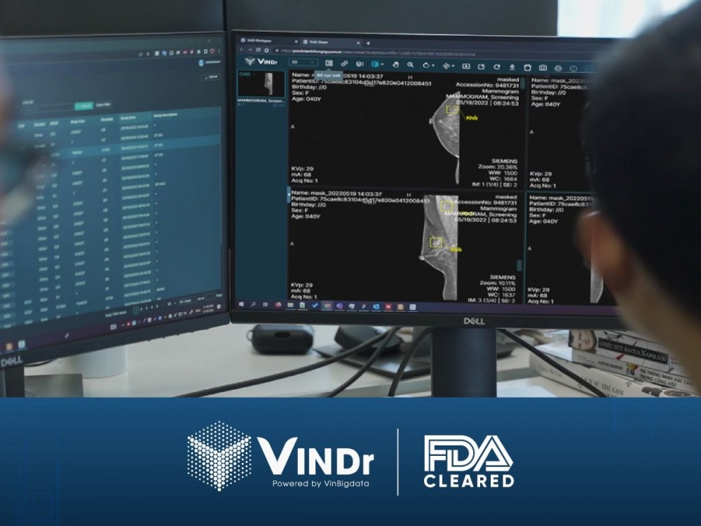 Theo đó, VinDr của VinBigdata là sản phẩm AI đầu tiên và duy nhất tại Việt Nam sở hữu chứng nhận của Cục quản lý Thực phẩm và Dược phẩm Hoa Kỳ (FDA) ở hạng mục phân tích ảnh X-quang tuyến vú.