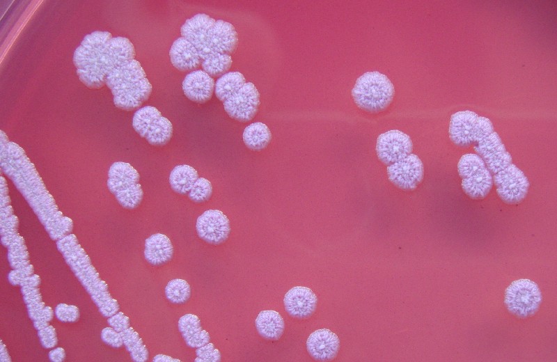Vi khuẩn B.pseudomallei nhìn qua kính hiển vi